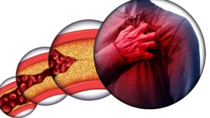 Read more about the article Early Signs of Heart Disease and How to Reduce the Risk