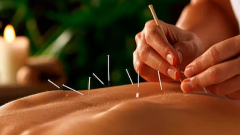 Acupuncture and Its Benefits